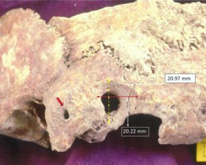 Обнаружили останки человека, которому провели операцию на мозге 1,6 тыс. лет назад