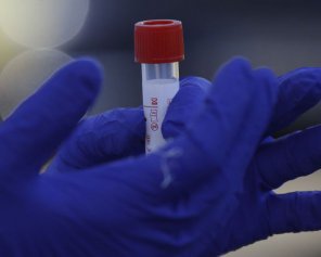 Померла санітарка пологового, в якої підозрювали Covid-19