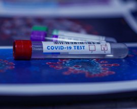 Коронавірус в Україні: вітчизняні ПЛР-тести направили в регіони