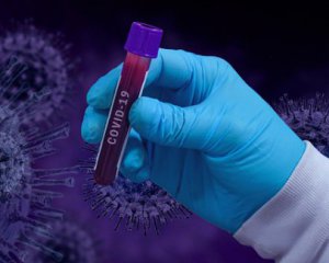 Минздрав инициирует увеличение ежедневного количества тестов на коронавирус