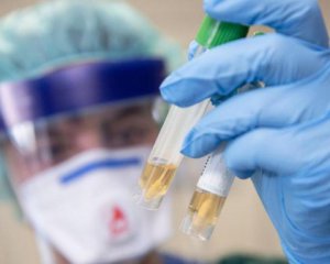 У Києві суттєво зменшилася кількість інфікованих Covid-19 за добу