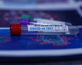 Столичні лабораторії не встигають робити аналізи на коронавірус