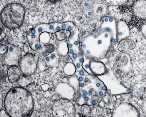 Окупанти заявляють про першу смерть від коронавірусу в Криму