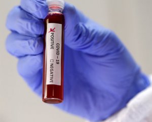 У Харківській обласній лікарні на Covid-19 захворіли 20 медиків