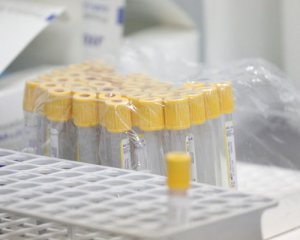 Коронавірус у Києві: назвали райони з найбільшим добовим приростом