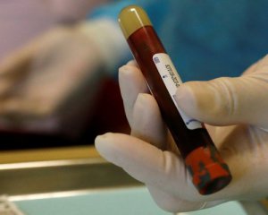 Коронавірус у Києві: Кличко повідомив неоптимістичні новини