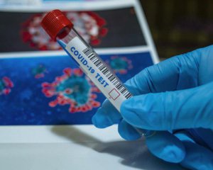 За добу коронавірус вбив в Україні 27 осіб