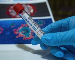 Количество больных коронавирусом в Украине достигает 150 тыс. - Ляшко