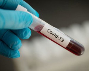 12% протестированных львовян имеют антитела к коронавирусу - горсовет