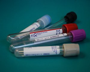 МОЗ планує вдвічі збільшити кількість тестів на коронавірус