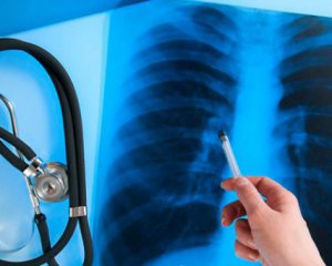 Вчені розкрили секрет самознищення туберкульозу