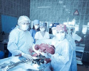 Хірурги 5 год. видаляли 10-кілограмову пухлину в нирці