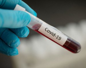 У Луганській ОДА ввели карантин у зв&#039;язку зі спалахом коронавірусу