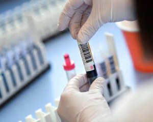 В Одесском горсовете зарегистрировали новые случаи инфицирования коронавирусом