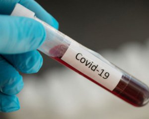 Коронавірус міг з'явитися ще 8 років тому - вчені