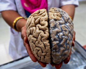 Кохання видно на МРТ: мозок вражає новими здатностями