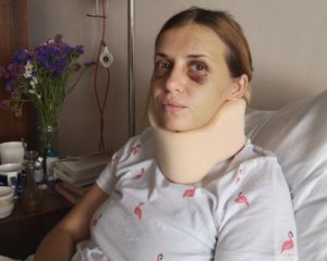 30 тис. грн за мовчання: побита в поїзді жінка розповіла про підкуп