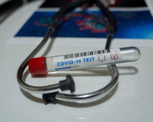 Скільки українців заразилися коронавірусом минулої доби