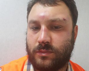 Побили голову профспілки автомобілістів