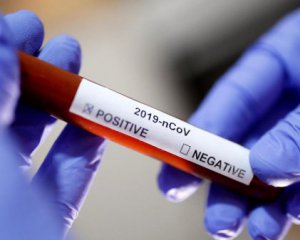 За сутки в Украине от коронавируса умерли 30 человек