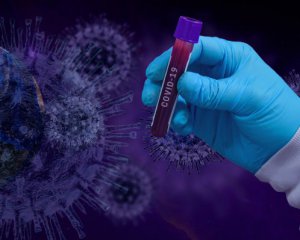 За добу в Україні від коронавірусу померли 53 людини