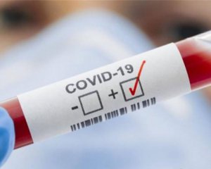 Итальянская компания создала самый быстрый тест на Covid-19