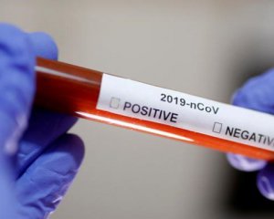 Безкоштовні тести на коронавірус можуть робити в приватних лабораторіях