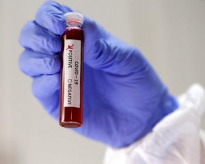 Коронавірус в Україні: кількість хворих стрімко зростає