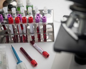 В Европе назвали приблизительное количество доз вакцины, которое может получить Украина