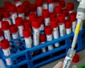 Covid-19. Украина получила заявку на испытания европейской вакцины