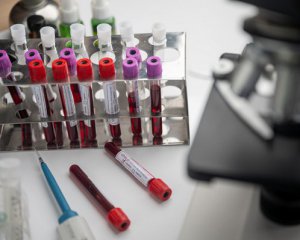 Вакцина от коронавируса может способствовать заражению ВИЧ - ученые