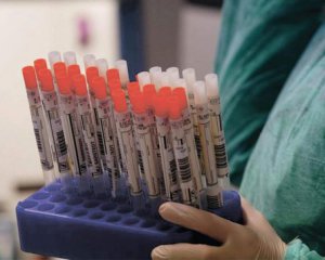 Украина установила новый печальный рекорд по коронавирусу