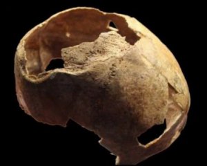 Нашли древний череп со следами успешной операции