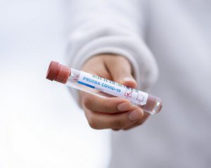 На Буковині зафіксували 457 нових випадків коронавірусу