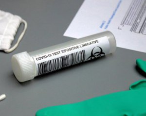 Медик спрогнозував, скільки українців перехворіли на коронавірус