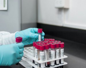 Чи обов&#039;язково українцям здавати тест на Covid-19 після закордонної поїздки
