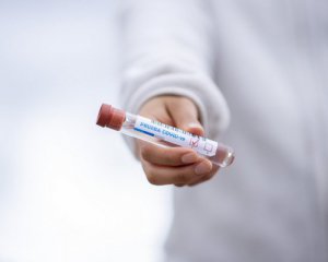 Пандемія коронавірусу: жителів Чехії будуть безкоштовно вакцинувати