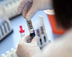 Назвали регіони з найгіршою епідситуацією